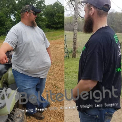 Douglas K - 2 Year Update*